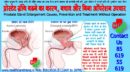 प्रोस्टेट ग्रंथि बढने का कारण, बचाव और बिना ऑपरेशन उपचार Prostate Gland Enlargement Causes, Prevention and Treatment Without Operation