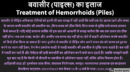 बवासीर (पाइल्स) का इलाज Treatment of Hemorrhoids (Piles)